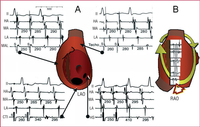 Invasive | Electrophysiologic Research