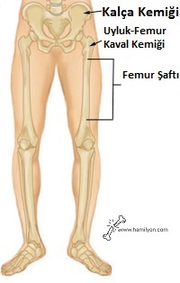 Femur Şaftı Kırıkları (Uyluk-Kaval Kemiği) – Femur Shaft Fractures (Broken Thighbone)